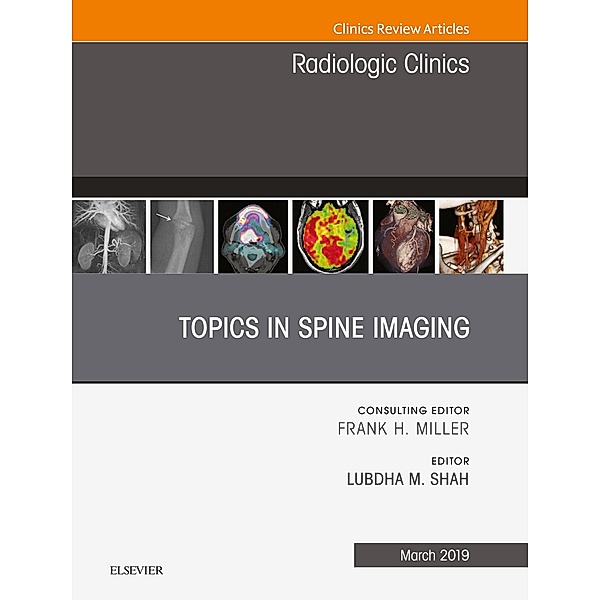 Topics in Spine Imaging, An Issue of Radiologic Clinics of North America, Lubdha M. Shah