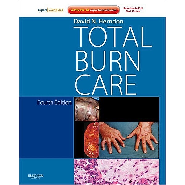 Total Burn Care, David N. Herndon