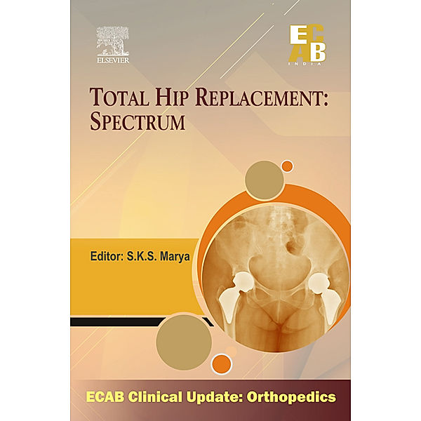 Total Hip Replacement Spectrum - ECAB