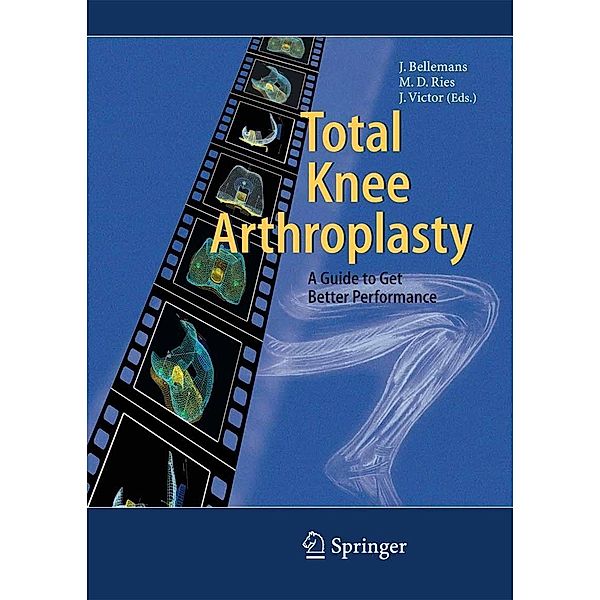 Total Knee Arthroplasty