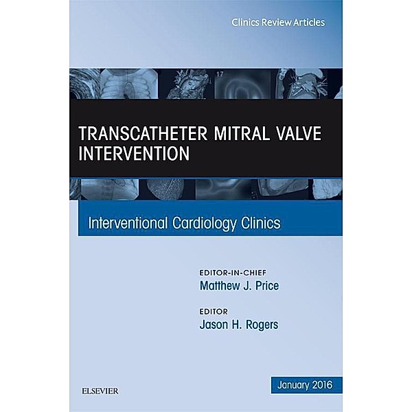 Transcatheter Mitral Valve Intervention, An Issue of Interventional Cardiology Clinics, Jason H. Rogers