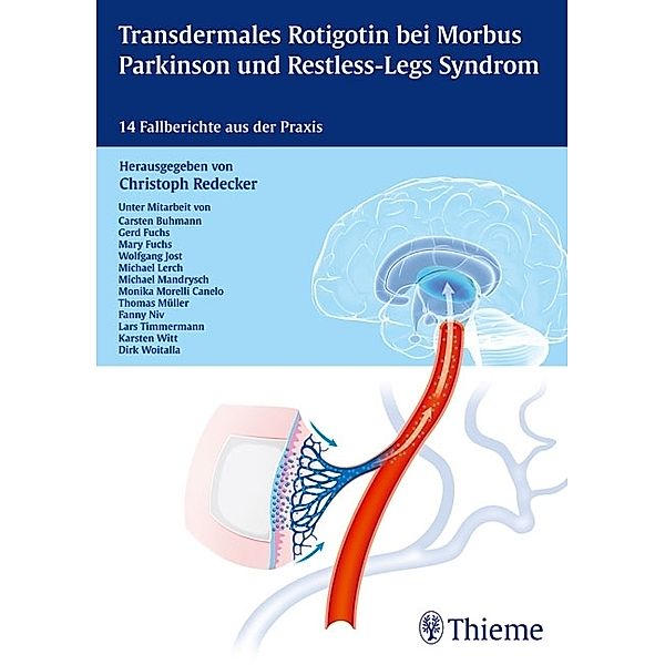 Transdermales Rotigotin bei Morbus Parkinson und Restless-Legs Syndrom