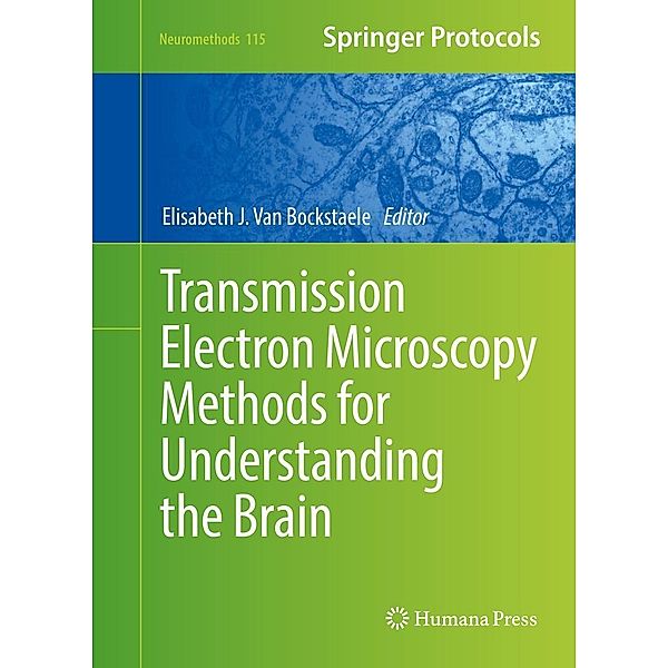Transmission Electron Microscopy Methods for Understanding the Brain / Neuromethods Bd.115