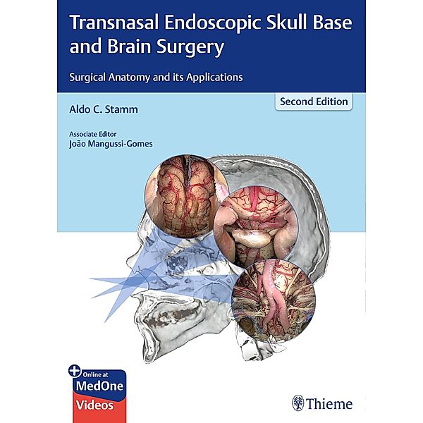 Transnasal Endoscopic Skull Base and Brain Surgery