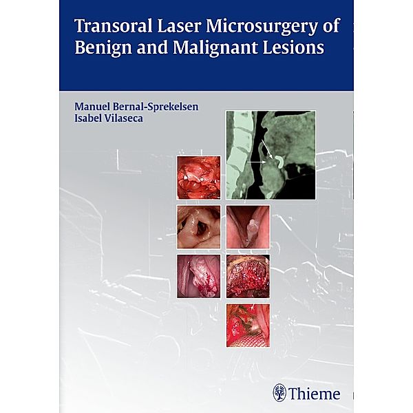 Transoral Laser Microsurgery of Benign and Malignant Lesions