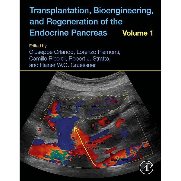 Transplantation, Bioengineering, and Regeneration of the Endocrine Pancreas