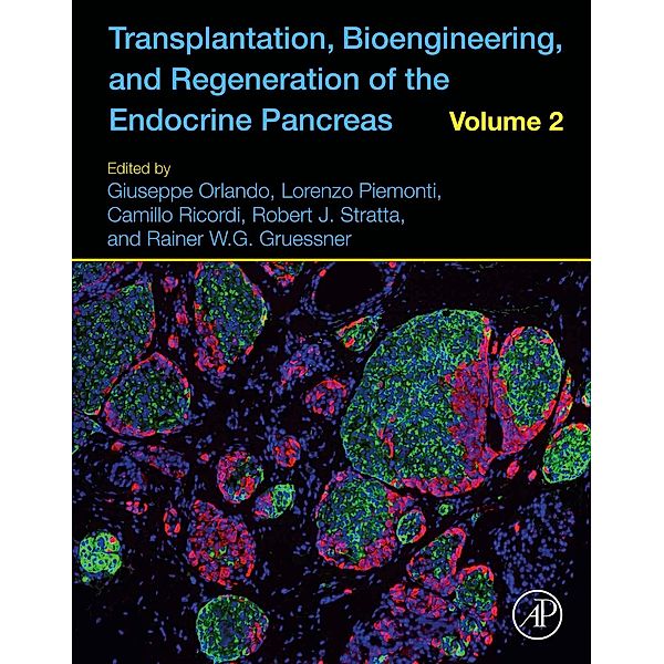 Transplantation, Bioengineering, and Regeneration of the Endocrine Pancreas