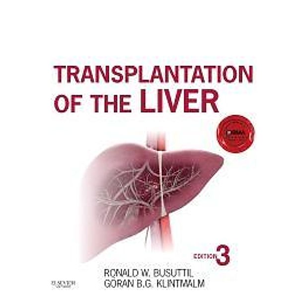 Transplantation of the Liver, Ronald W. Busuttil, Goran B. Klintmalm