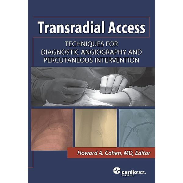 Transradial Access: Techniques for Diagnostic Angiography and Percutaneous Intervention