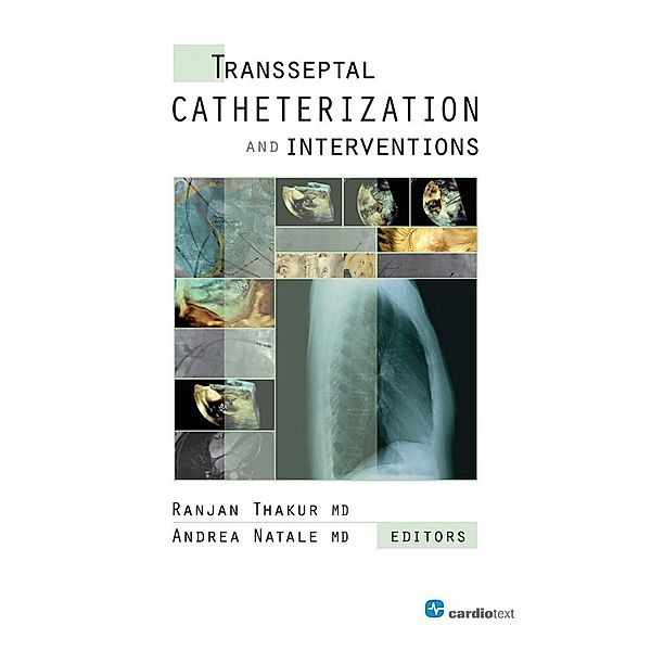 Transseptal Catheterization and Interventions