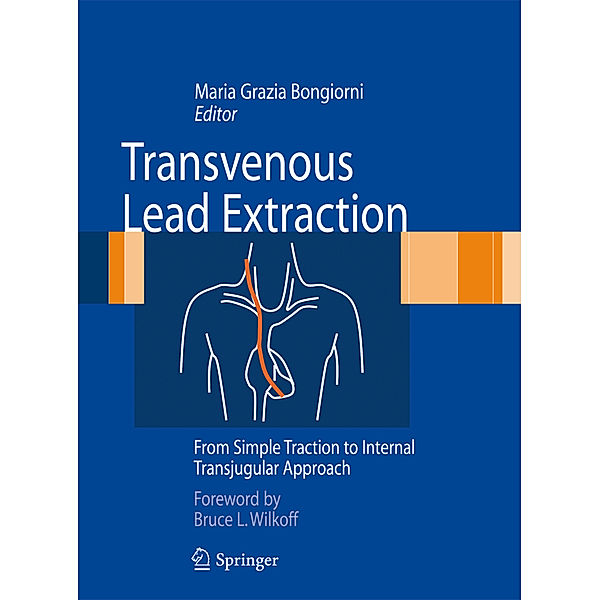 Transvenous Lead Extraction, Maria Grazia Bongiorni