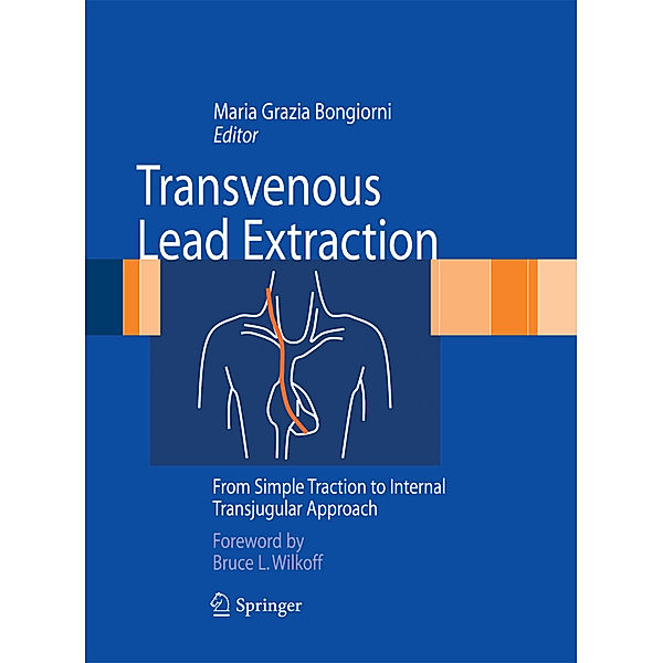 Transvenous Lead Extraction