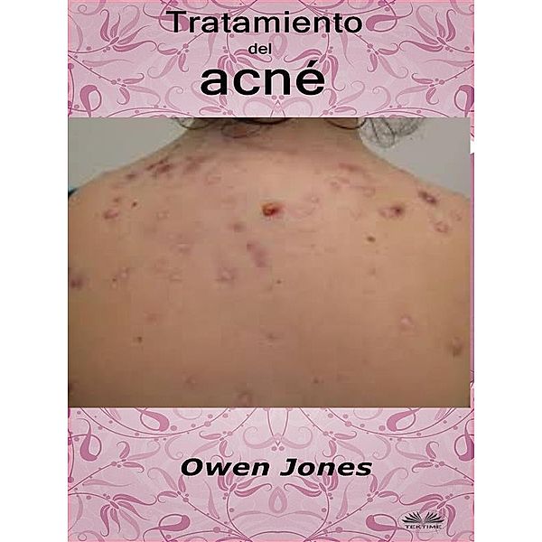 Tratamiento Del Acné, Owen Jones