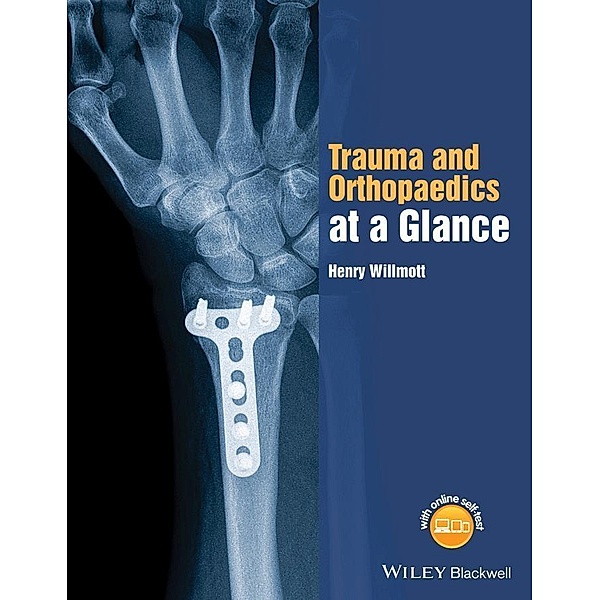Trauma and Orthopaedics at a Glance / At a Glance, Henry Willmott