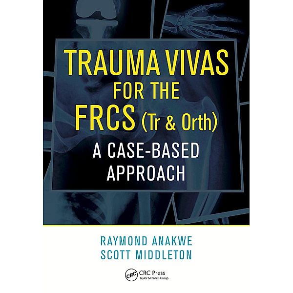 Trauma Vivas for the FRCS, Raymond Anakwe, Scott Middleton