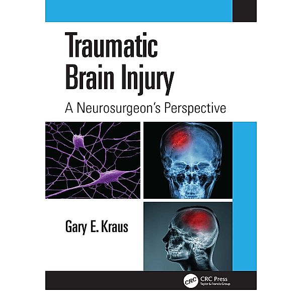 Traumatic Brain Injury: A Neurosurgeon's Perspective, Gary E. Kraus