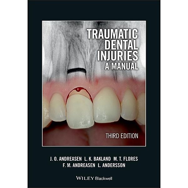 Traumatic Dental Injuries, Jens O. Andreasen, Leif K. Bakland, Maria Teresa Flores, Frances M. Andreasen, Lars Andersson
