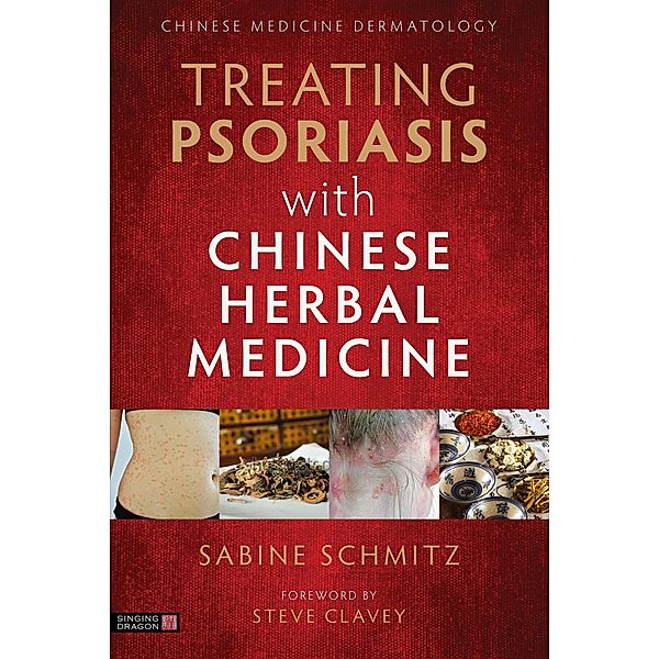 Treating Psoriasis with Chinese Herbal Medicine (Revised Edition), Sabine Schmitz
