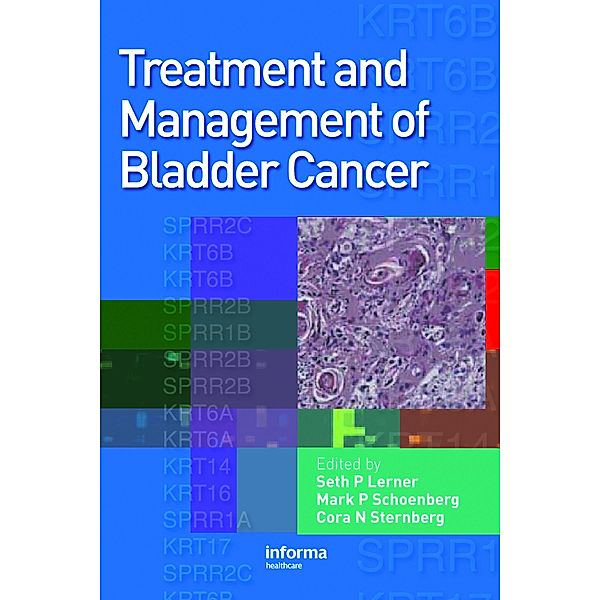 Treatment and Management of Bladder Cancer