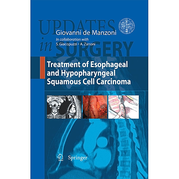 Treatment of Esophageal and Hypopharingeal Squamous Cell Carcinoma