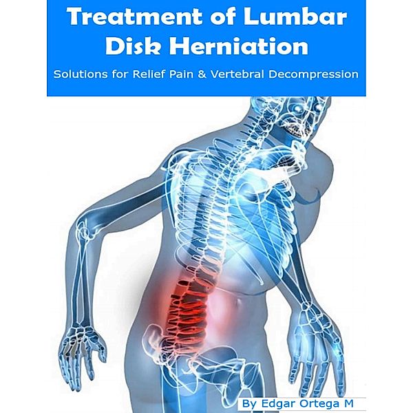 Treatment of Lumbar Disk Herniation, Edgar Ortega M.