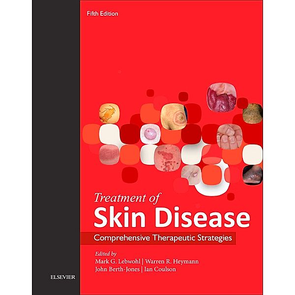 Treatment of Skin Disease E-Book, Mark G. Lebwohl, Warren R. Heymann, John Berth-Jones, Ian Coulson