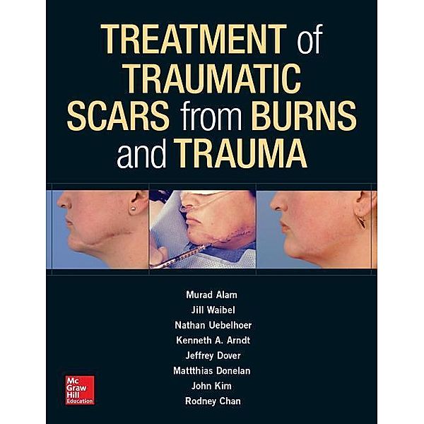 Treatment of Traumatic Scars from Burns and Trauma, Murad Alam, Jill Waibel, Nathan Uebelhoer