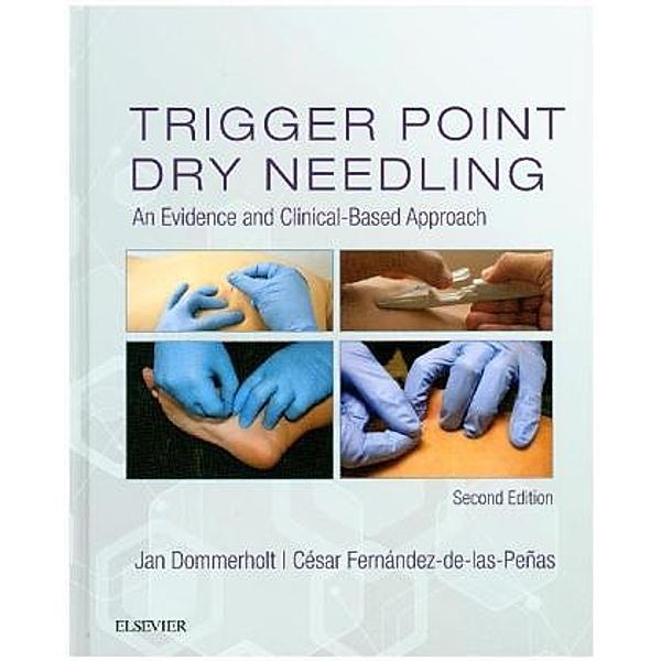 Trigger Point Dry Needling, Jan Dommerholt, Cesar Fernandez de las Penas