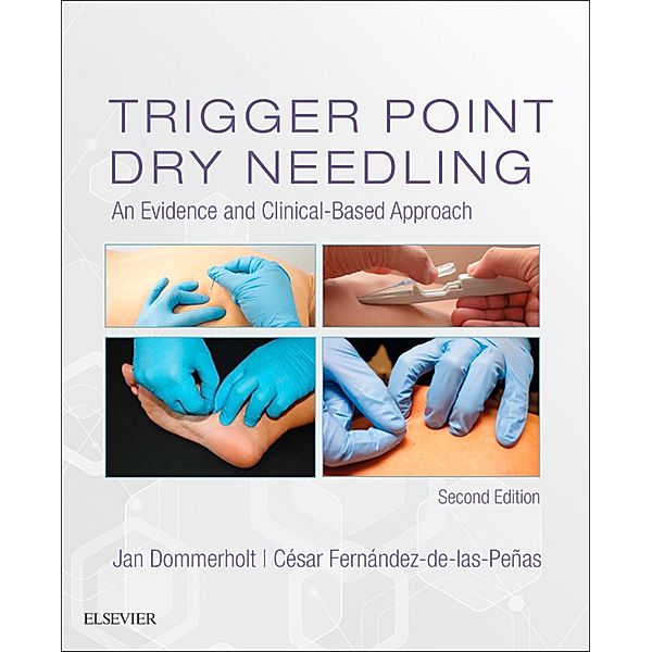 Trigger Point Dry Needling E-Book, Jan Dommerholt, Cesar Fernandez de las Penas