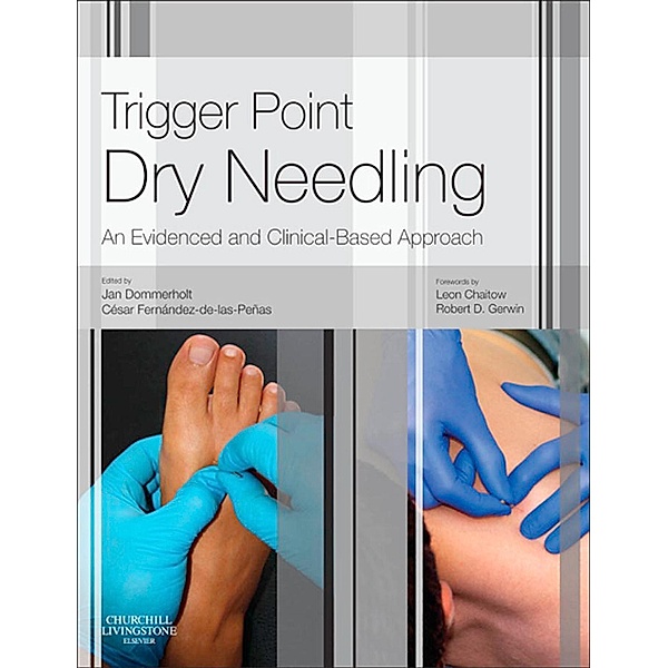 Trigger Point Dry Needling E-Book, Jan Dommerholt, Cesar Fernandez de las Penas