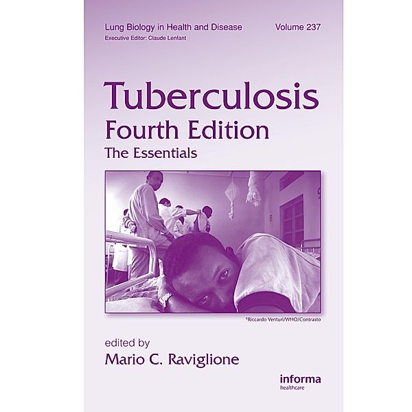 Tuberculosis