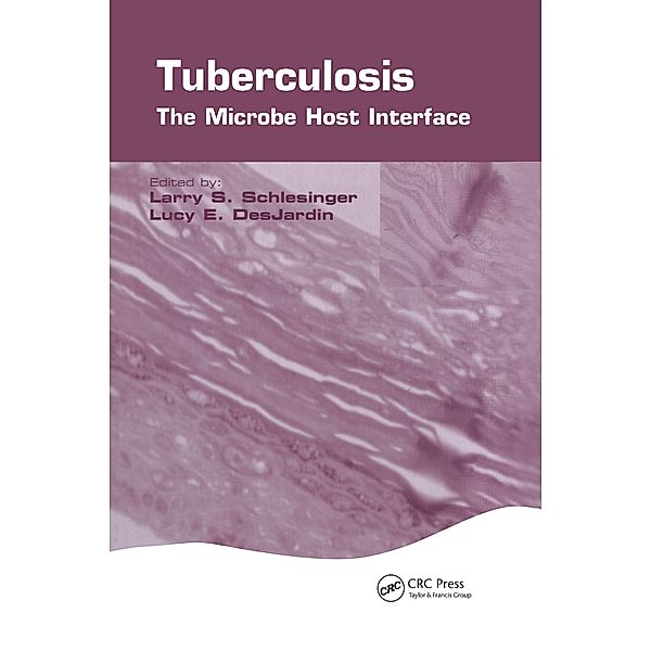 Tuberculosis, Larry S. Schlesinger, Lucy E. Desjardin