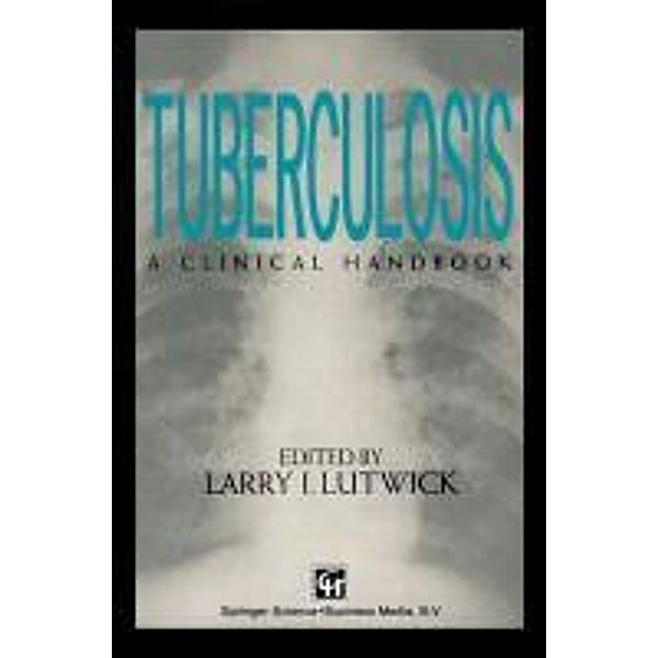 Tuberculosis, Larry Lutwick