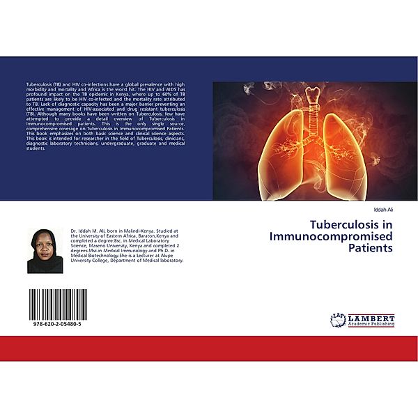 Tuberculosis in Immunocompromised Patients, Iddah Ali