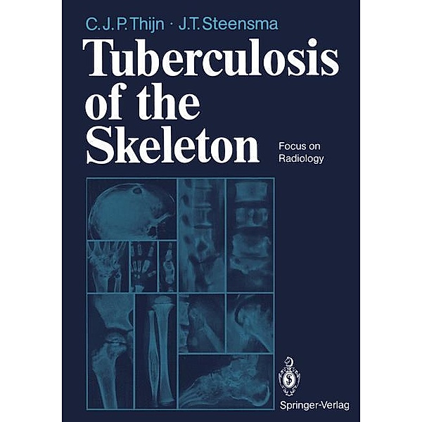 Tuberculosis of the Skeleton, Cornelis J.P. Thijn, Jieldouw T. Steensma