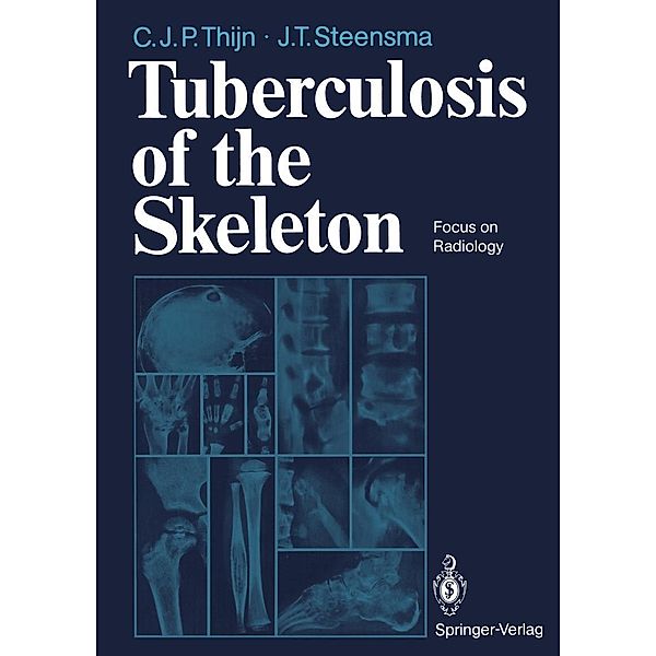 Tuberculosis of the Skeleton, Cornelis J. P. Thijn, Jieldouw T. Steensma