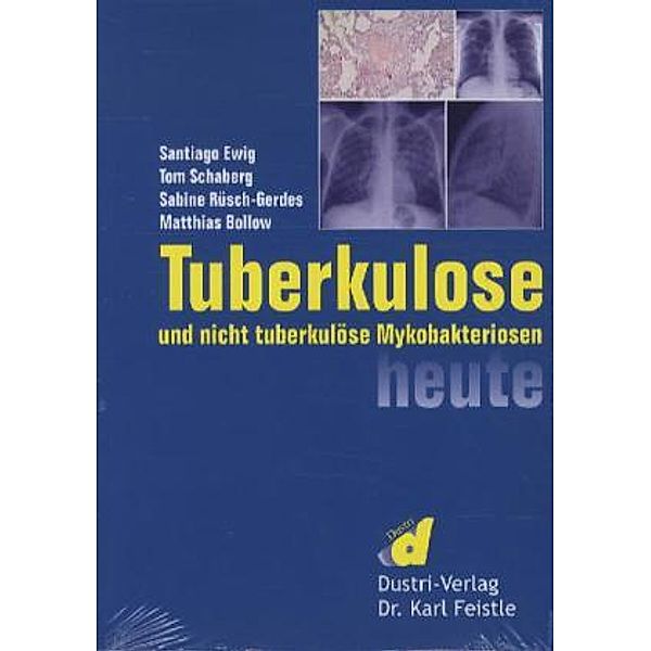 Tuberkulose und nicht tuberkulöse Mykobakteriosen heute, Santiago Ewig