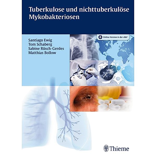 Tuberkulose und nicht tuberkulöse Mykobakteriosen, Santiago Ewig, Tom Schaberg, Sabine Rüsch-Gerdes, Matthias Bollow