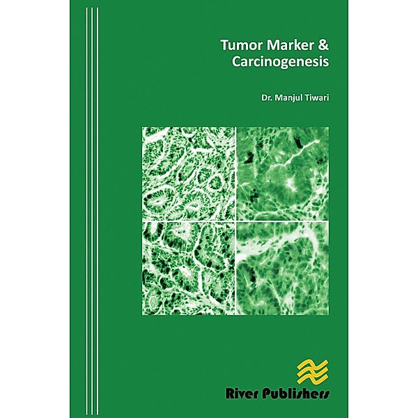 Tumor Marker and Carcinogenesis, Manjul Tiwari