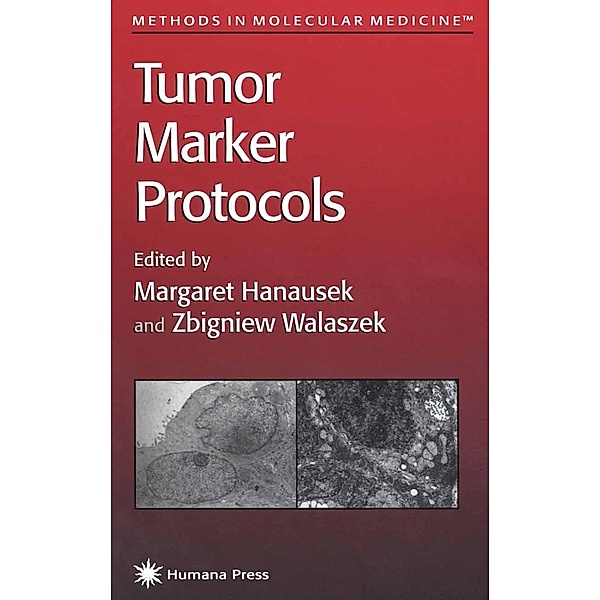 Tumor Marker Protocols / Methods in Molecular Medicine Bd.14