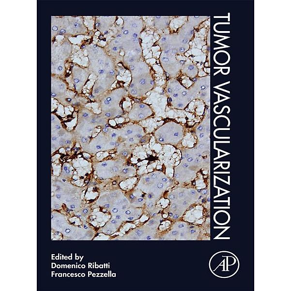 Tumor Vascularization