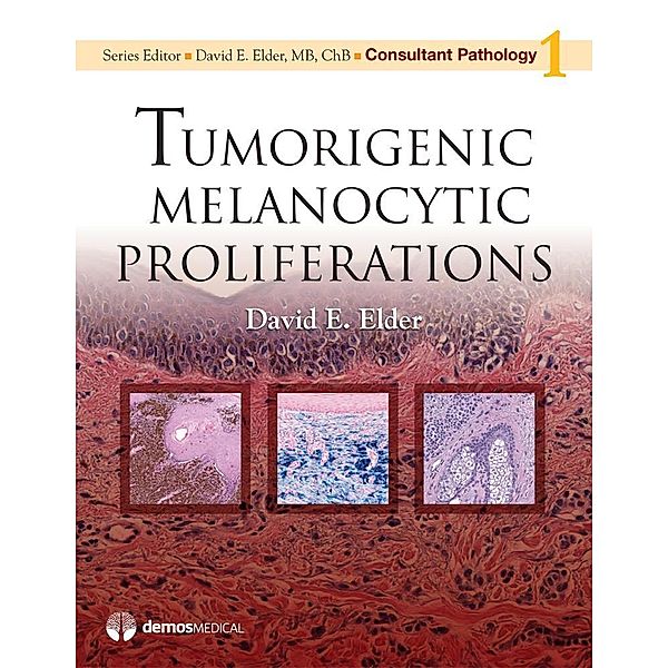 Tumorigenic Melanocytic Proliferations / Consultant Pathology Bd.Volume 1, David E. Elder