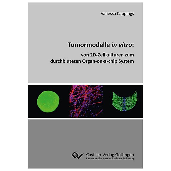 Tumormodelle in vitro, Vanessa Kappings