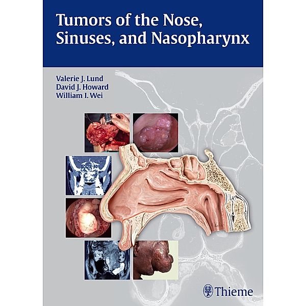 Tumors of the Nose, Sinuses and Nasopharynx, Valerie J. Lund, David Howard, William I. Wei