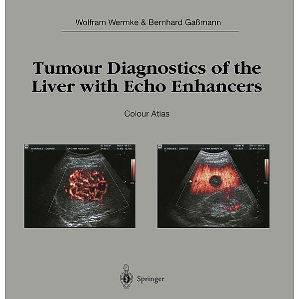 Tumour Diagnostics of the Liver with Echo Enhancers, Wolfram Wermke, Bernhard Gassmann