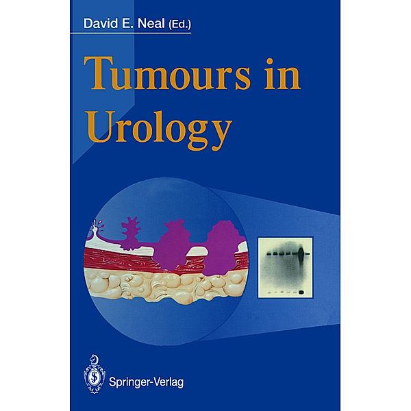 Tumours in Urology