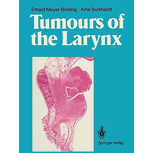 Tumours of the Larynx, Erhard Meyer-Breiting, Arne. Burkhardt