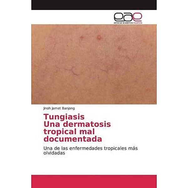 TungiasisUna dermatosis tropical mal documentada, Jinoh Jamet Banjong