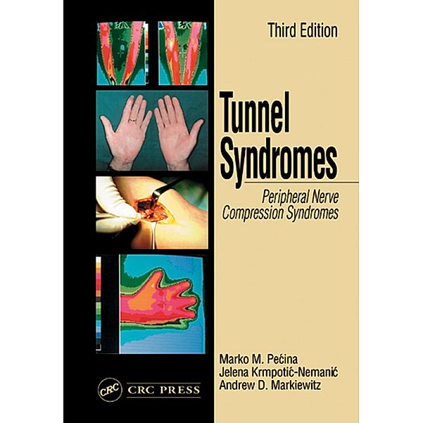 Tunnel Syndromes, Marko M. Pecina, Andrew D. Markiewitz, Jelena Krmpotic-Nemanic