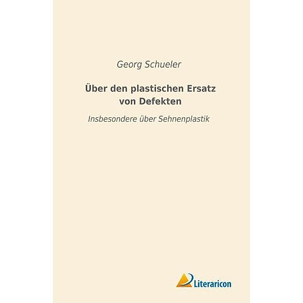 Über den plastischen Ersatz von Defekten, Georg Schueler